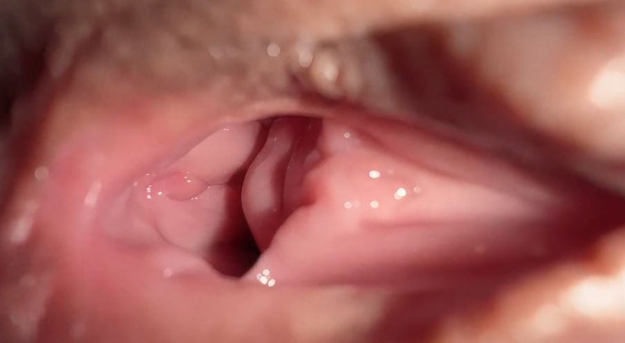 can-canh-am-dao-co-gai-18-tuoi-khi-bi-mat-trinh